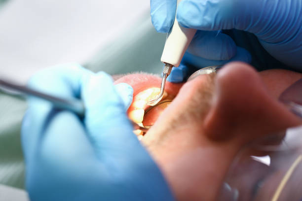 Best Same-Day Emergency Dental Services in La Homa, TX