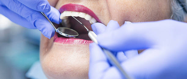 Best Emergency Treatment for Dental Infections or Abscesses in La Homa, TX